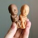 i have a dream that brown fetuses and pink fetuses shall snuggle in the same mailing envelope