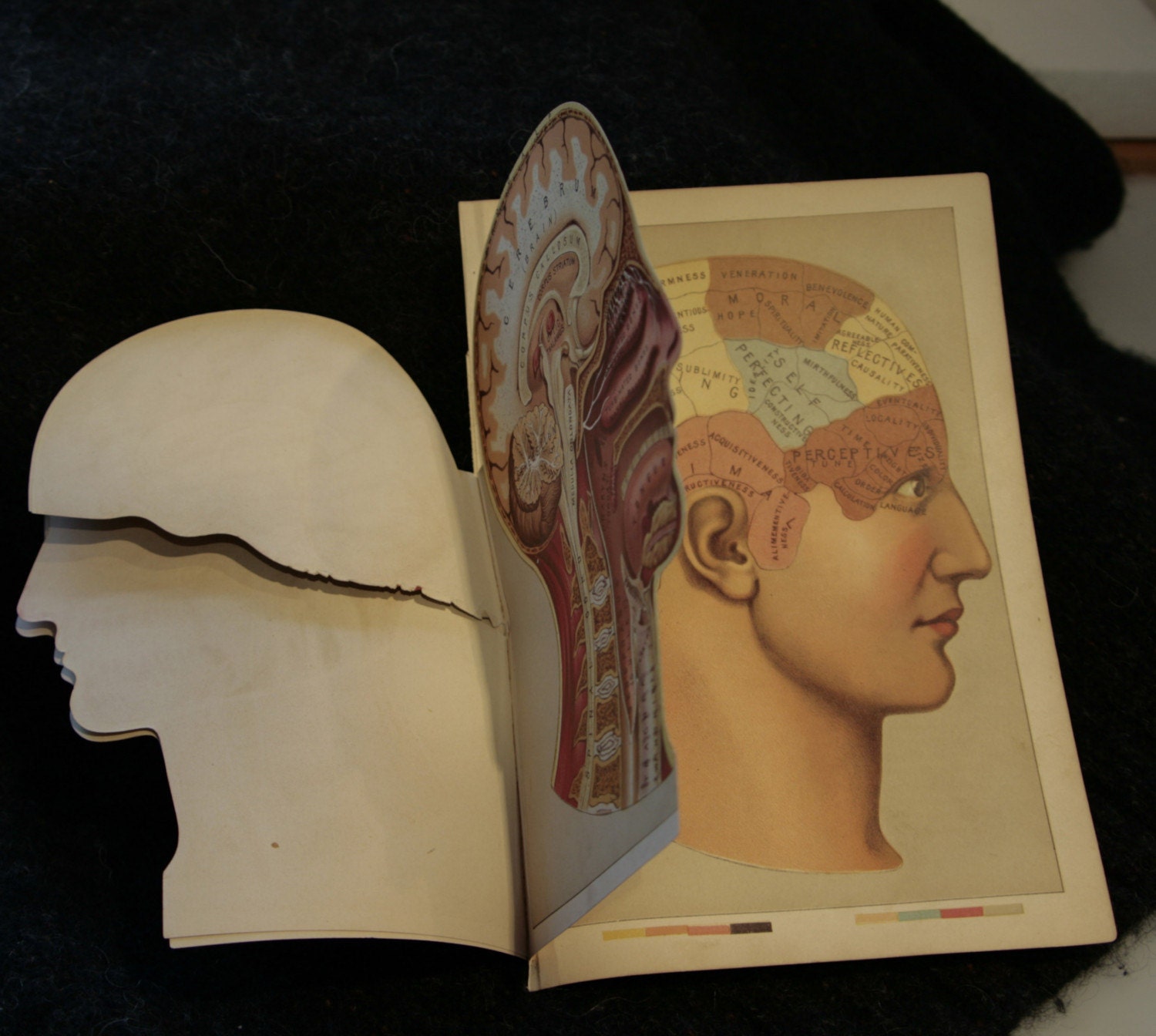 Medical Book Illustration of Head With Fold Out Sections