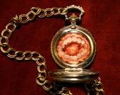 Dental Pocket Watch