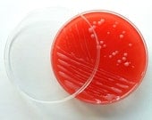 Soap - White E. coli on Blood Agar (Coconut)