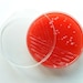 Soap - White E. coli on Blood Agar (Coconut)