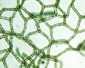 Hydrodictyon - Green Algae Microscopy