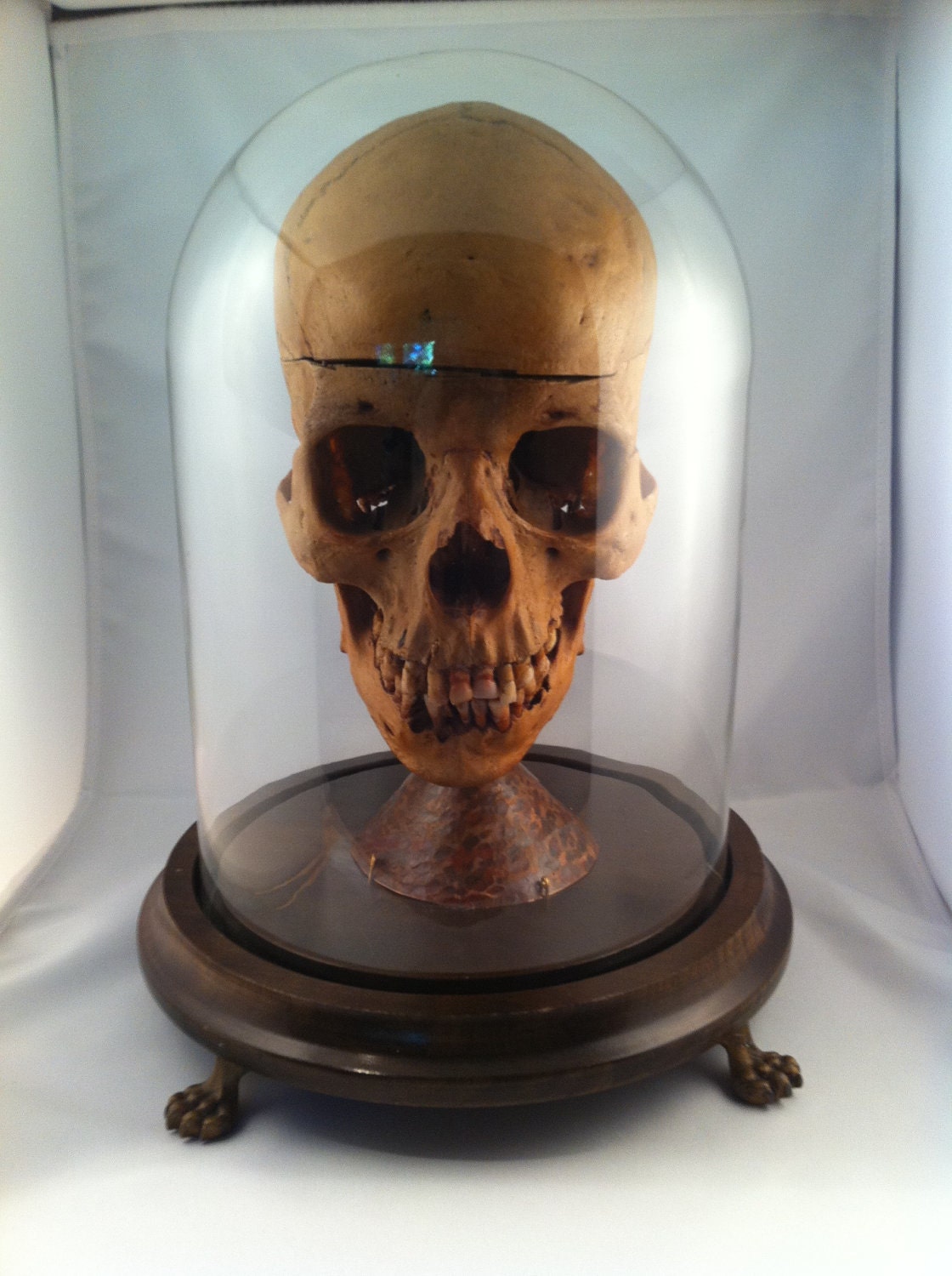 30 week old Human Fetal Skelton in glass Cloche Dome