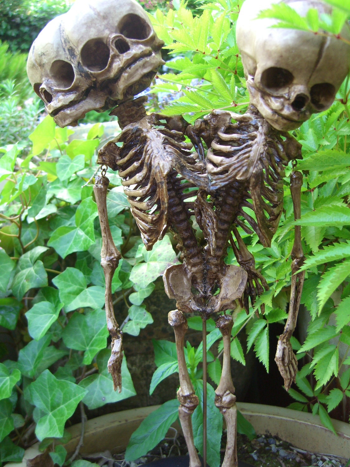 Conjoined Twins Siamese Fetal Skeletons, made to order.