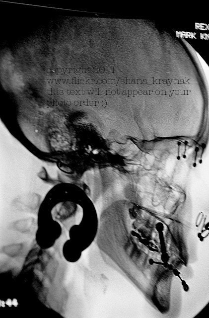 punk rock skull x-ray photo