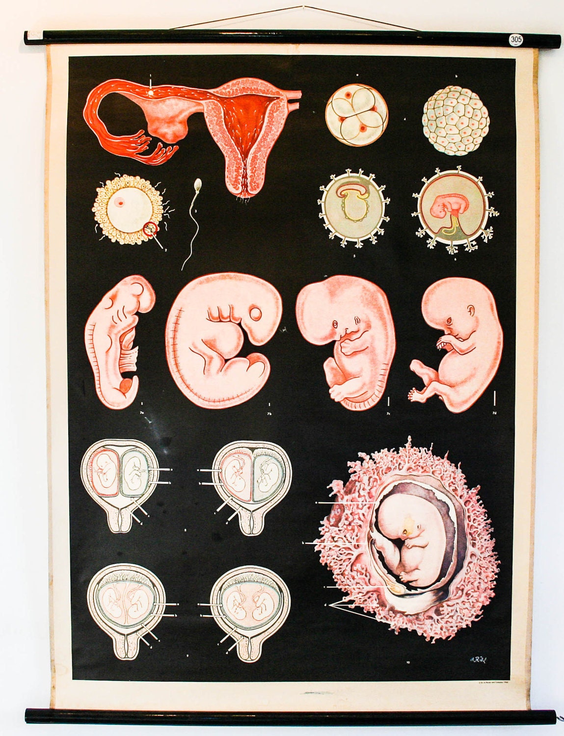 pull down map embryology, german make wall print, genuine vintage biology chart