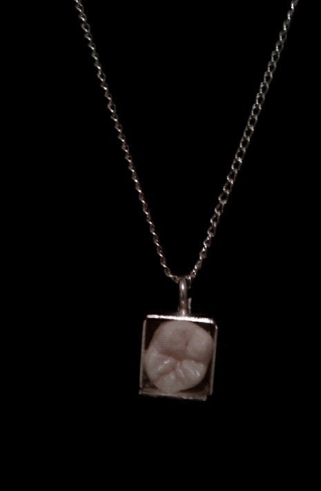 Tooth in a Box Necklace
