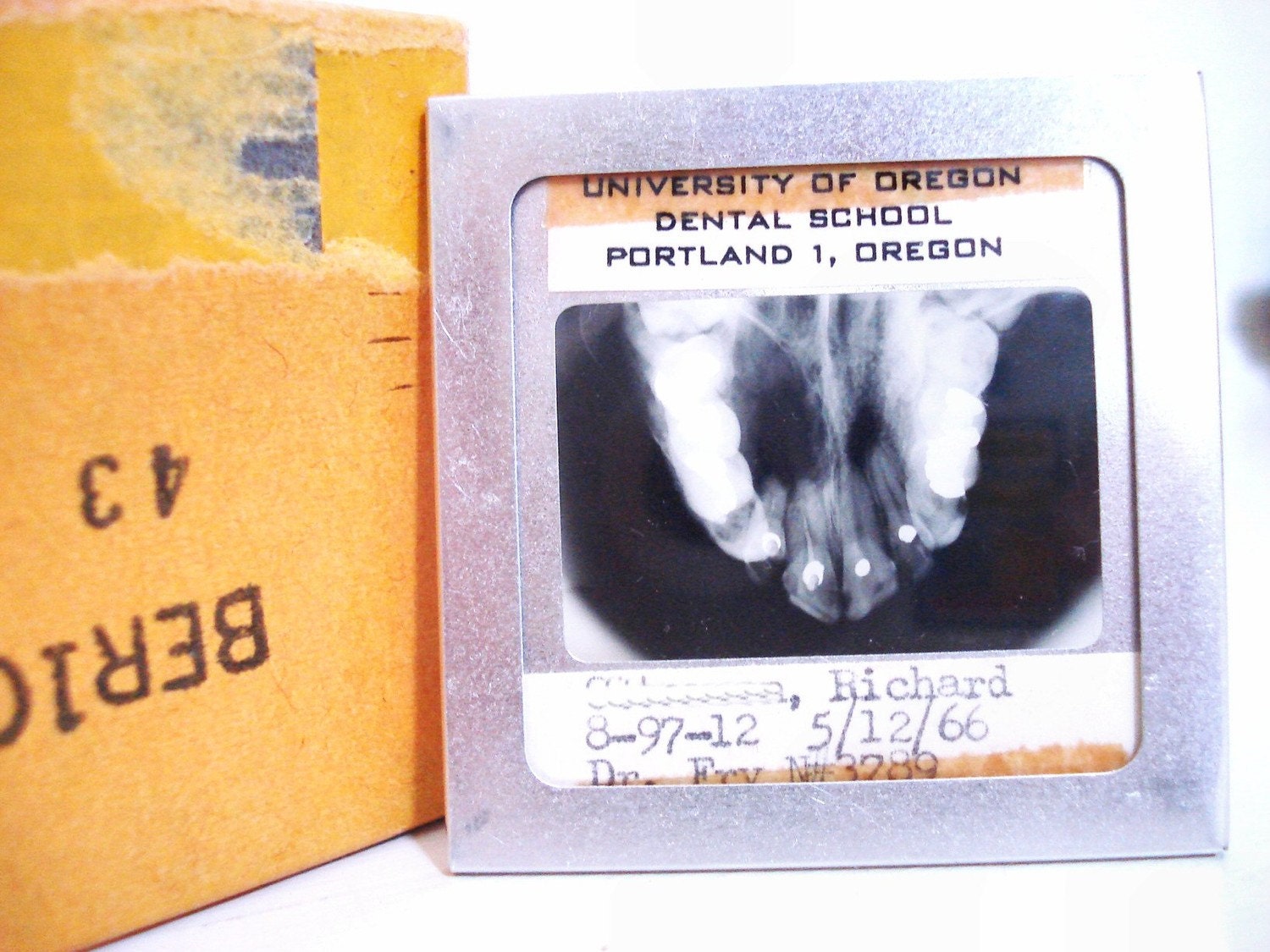 Set of 25 vintage dental slides of x-rays, molds, dental work, graphs, anatomy, gory, disease, people at the dentist's office