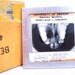 Set of 25 vintage dental slides of x-rays, molds, dental work, graphs, anatomy, gory, disease
