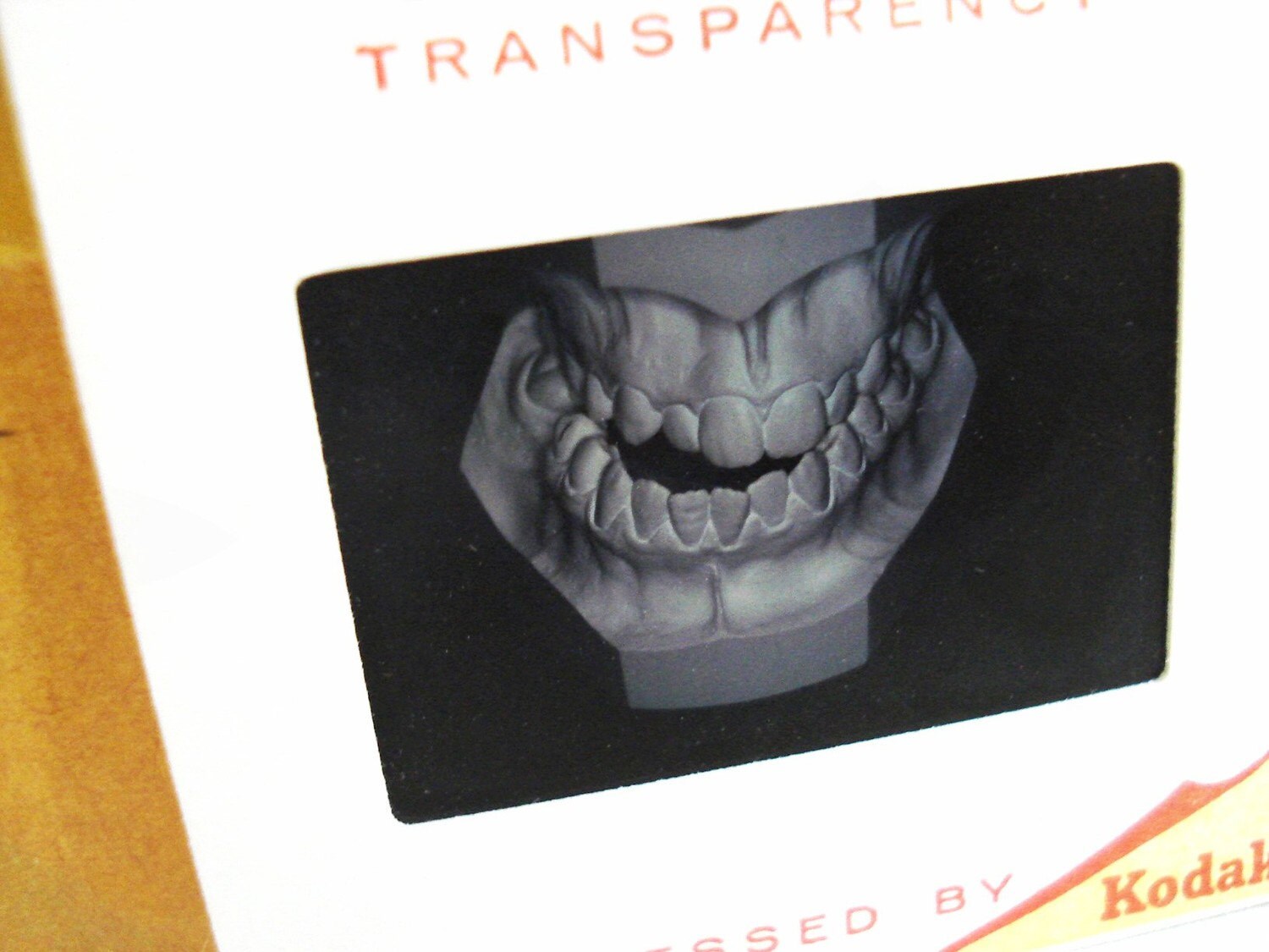 Dental Graphs