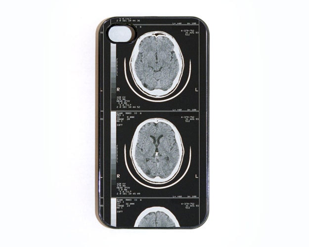 iphone 4 case with Brain Scan X-Ray - Choose Black Case or White Case