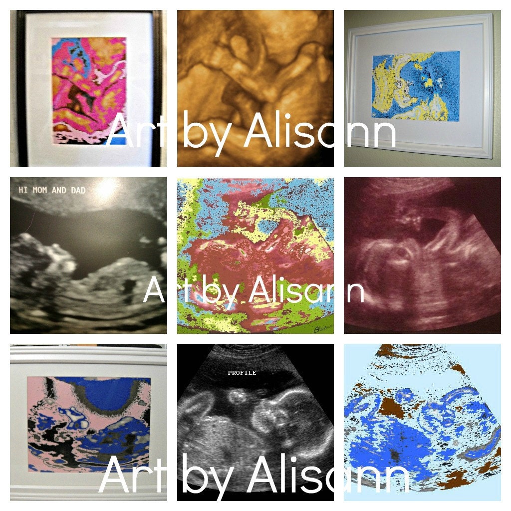 Ultrasound Art - 5 x7 artwork in an 8x10 Frame -Custom Newborn Baby Gift - Baby Shower Gift - Framed Sonogram - Unique Baby Gift-TAGT
