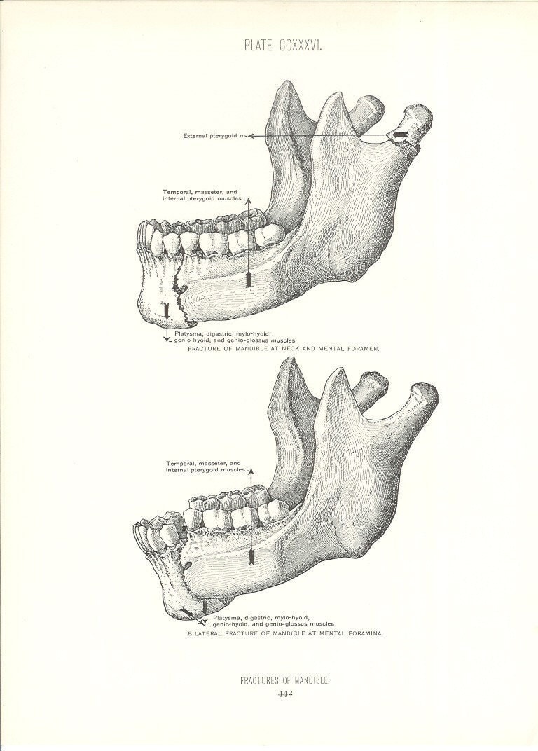anatomy jaw