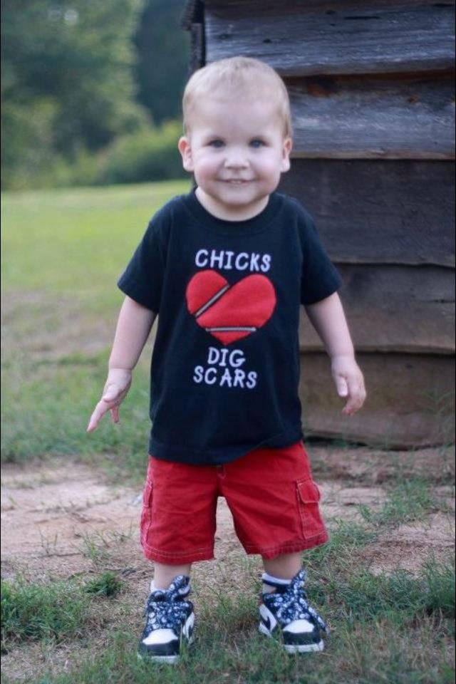 CHD- Chicks/Dudes Dig Scars Shirt