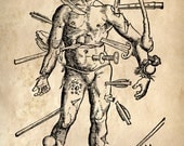 12x16 Vintage Anatomy. Wounded Man. Antique Weapons. Swords. Knives -029