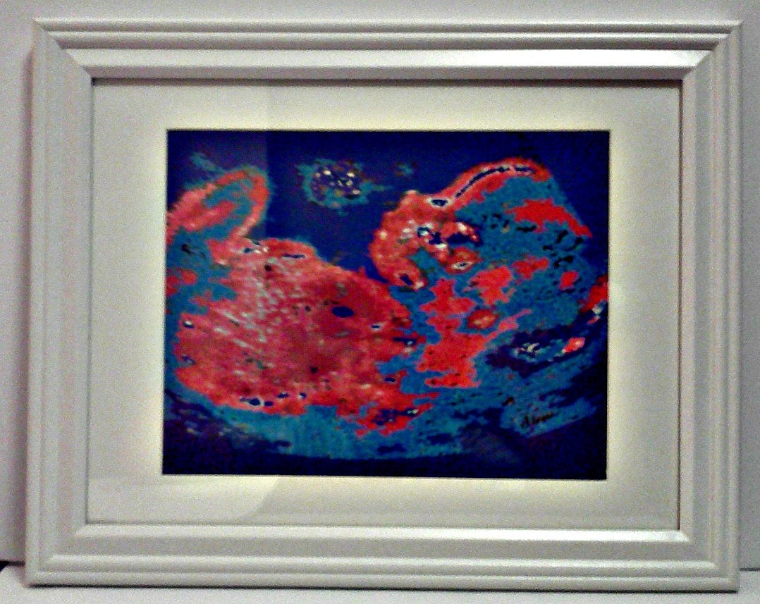 Ultrasound Art - 5 x7 artwork in an 8x10 Frame -Custom Newborn Baby Gift - Baby Shower Gift - Framed Sonogram - Unique Baby Gift-TAGT