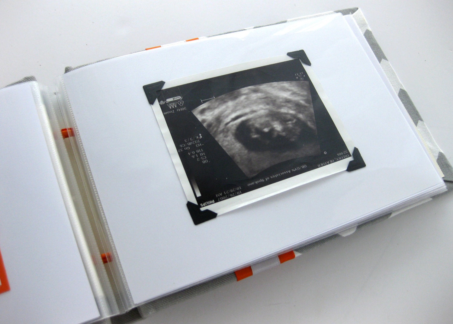 Ultrasound baby photo album -5x7 Chevron brag book choose your own colors