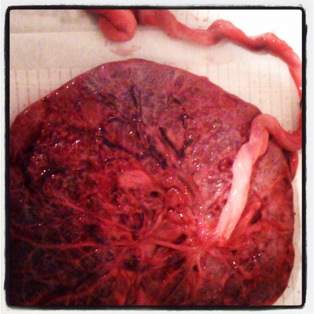 DIY Placenta Tincture Kit