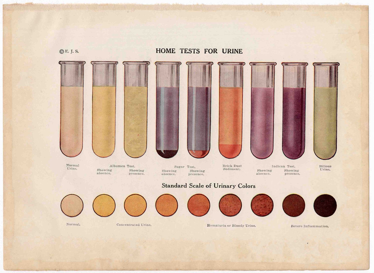1912 urine analysis original antique medical science print - urinalysis