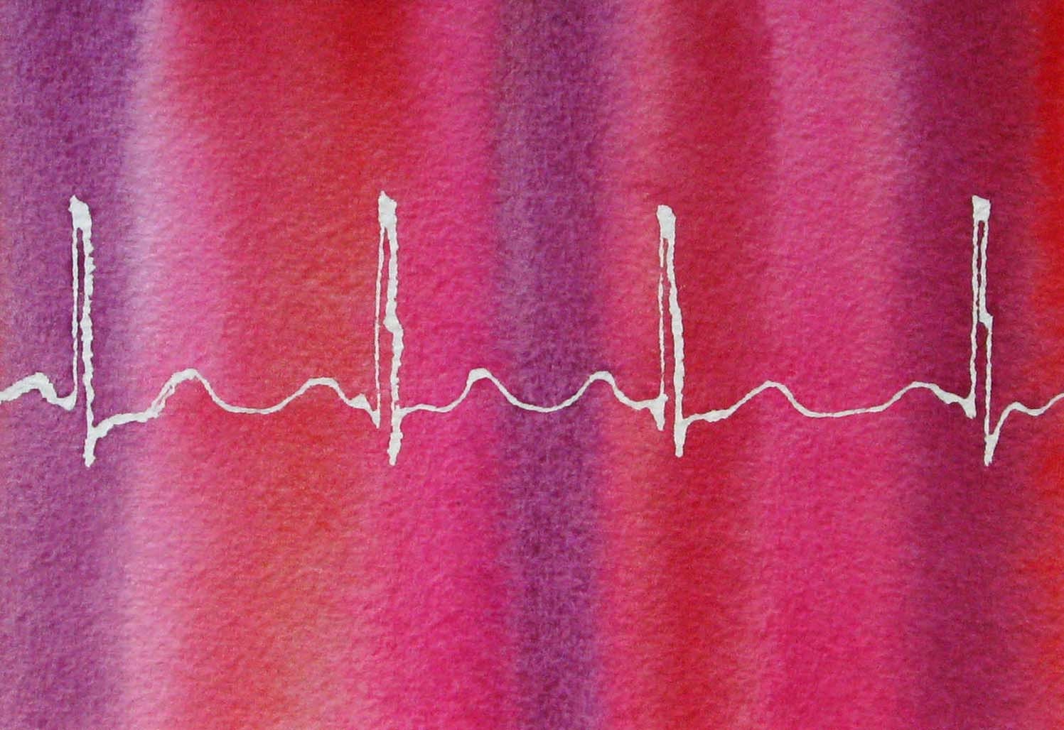 Fairly Normal Heartbeat (Pink) - original watercolor ekg painting