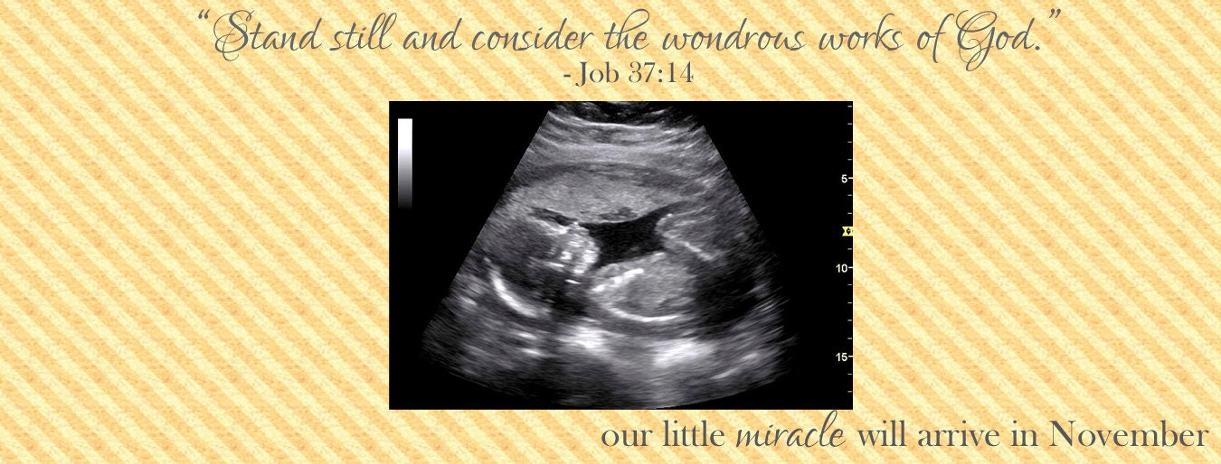 Pregnancy Announcement Facebook Cover Photo Wondrous Works Of God