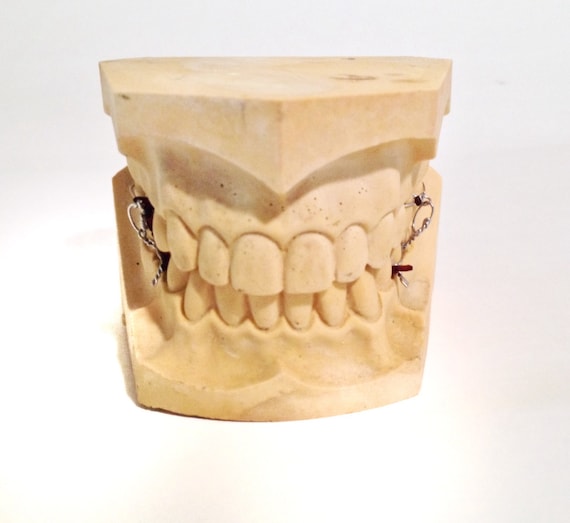 Vintage Plaster Dental Mold Teeth by VintageFunkHouser on Etsy