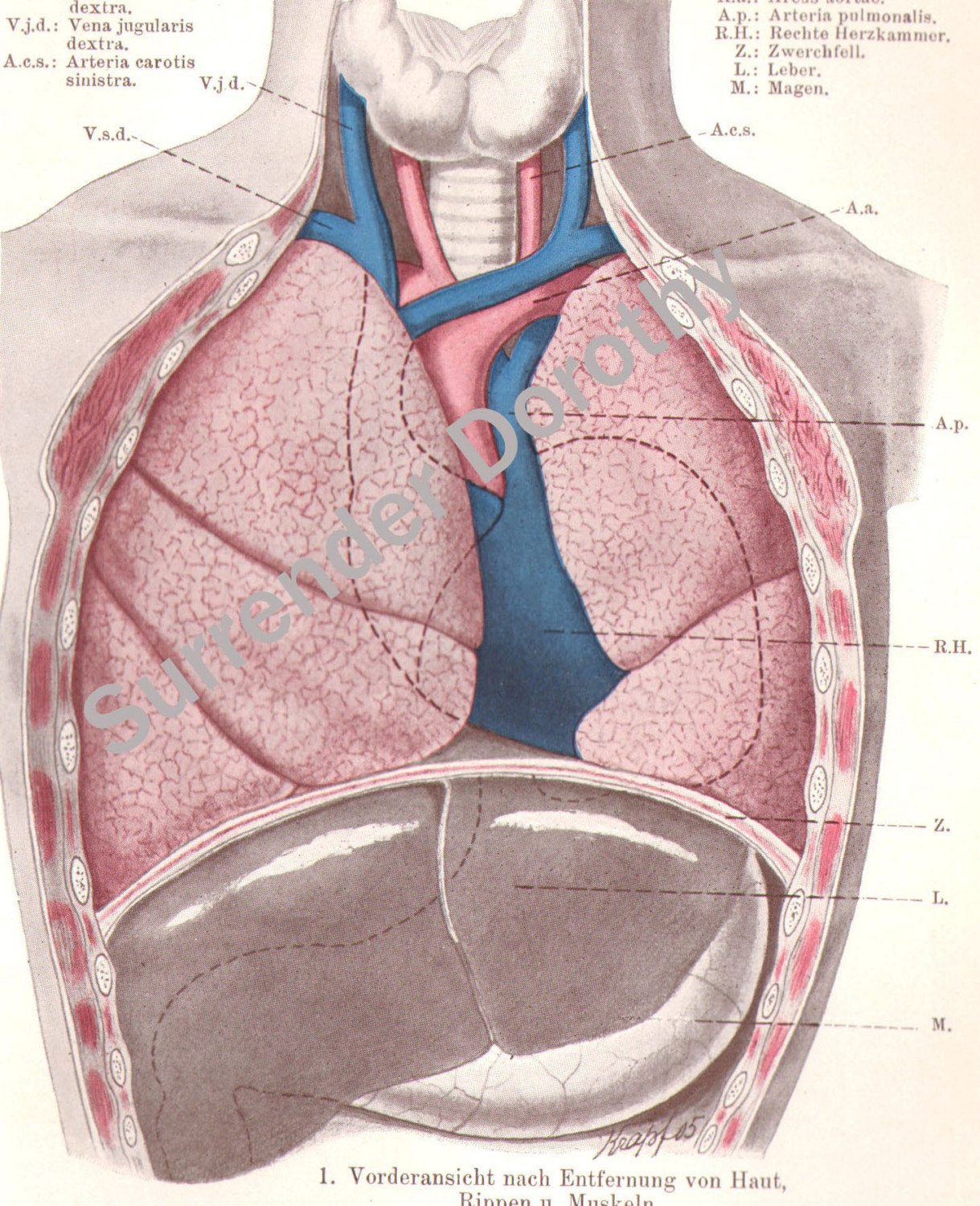 Diagram Of Chest Area - 2: Schematic of the chest wall musculature