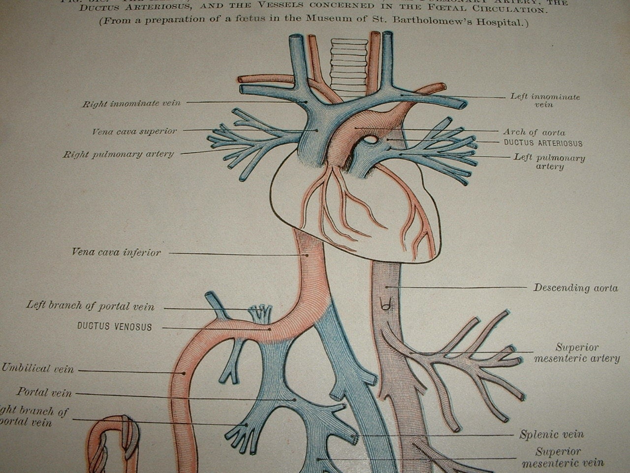 1900 FETAL CIRCULATION Antique Engraving for by theCandyShoppe