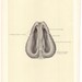 1899 Antique CARTILAGE OF NOSE Surgical Anatomy Illustration