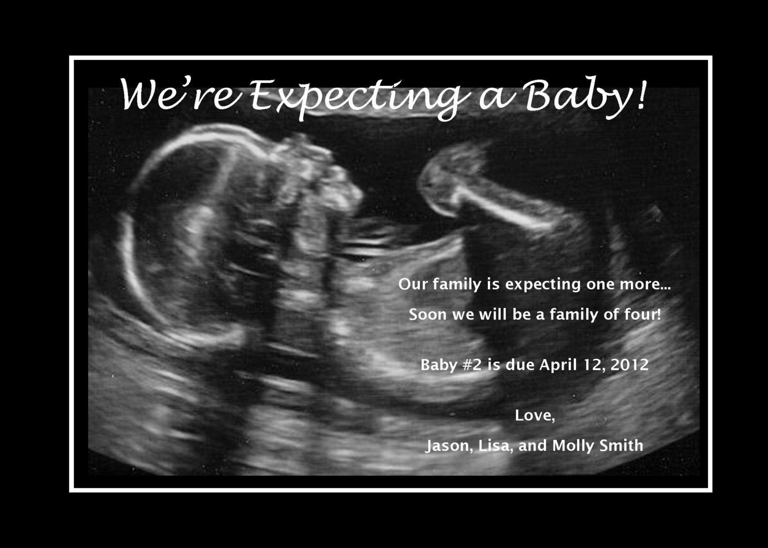Pregnancy Expecting Announcement Featuring Your Ultrasound or