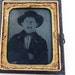 Antique Tintype photo screaming boy in arm brace