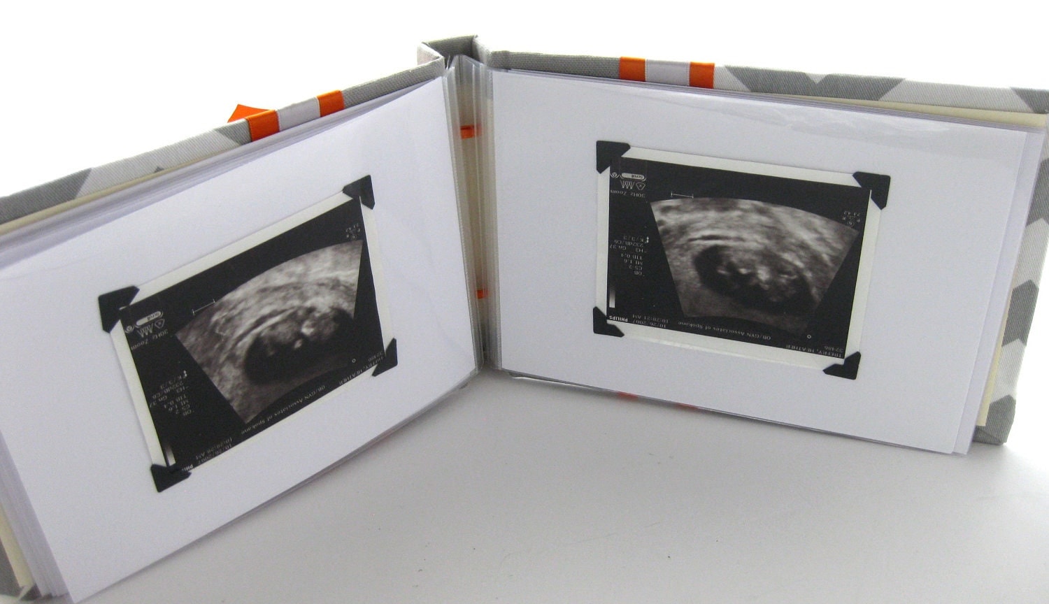 Ultrasound baby photo album 5x7 Chevron brag book choose your