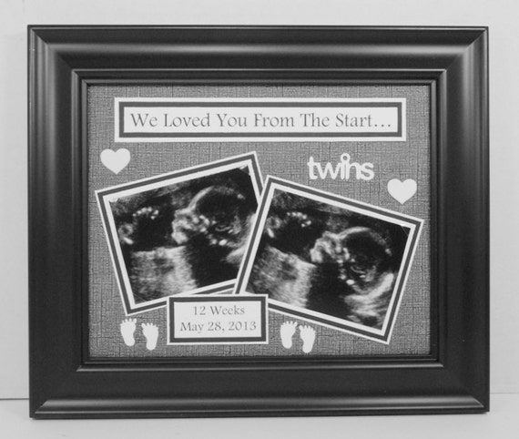 michaels ultrasound frame