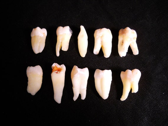 10 Real Human Teeth Taxidermy Bone Teeth Molar Incisor