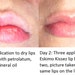 Thieves Oil Lip Balm - Organic - Kills Germs - Antibacterial Lip Balm - Buy 4 Get 1 FREE