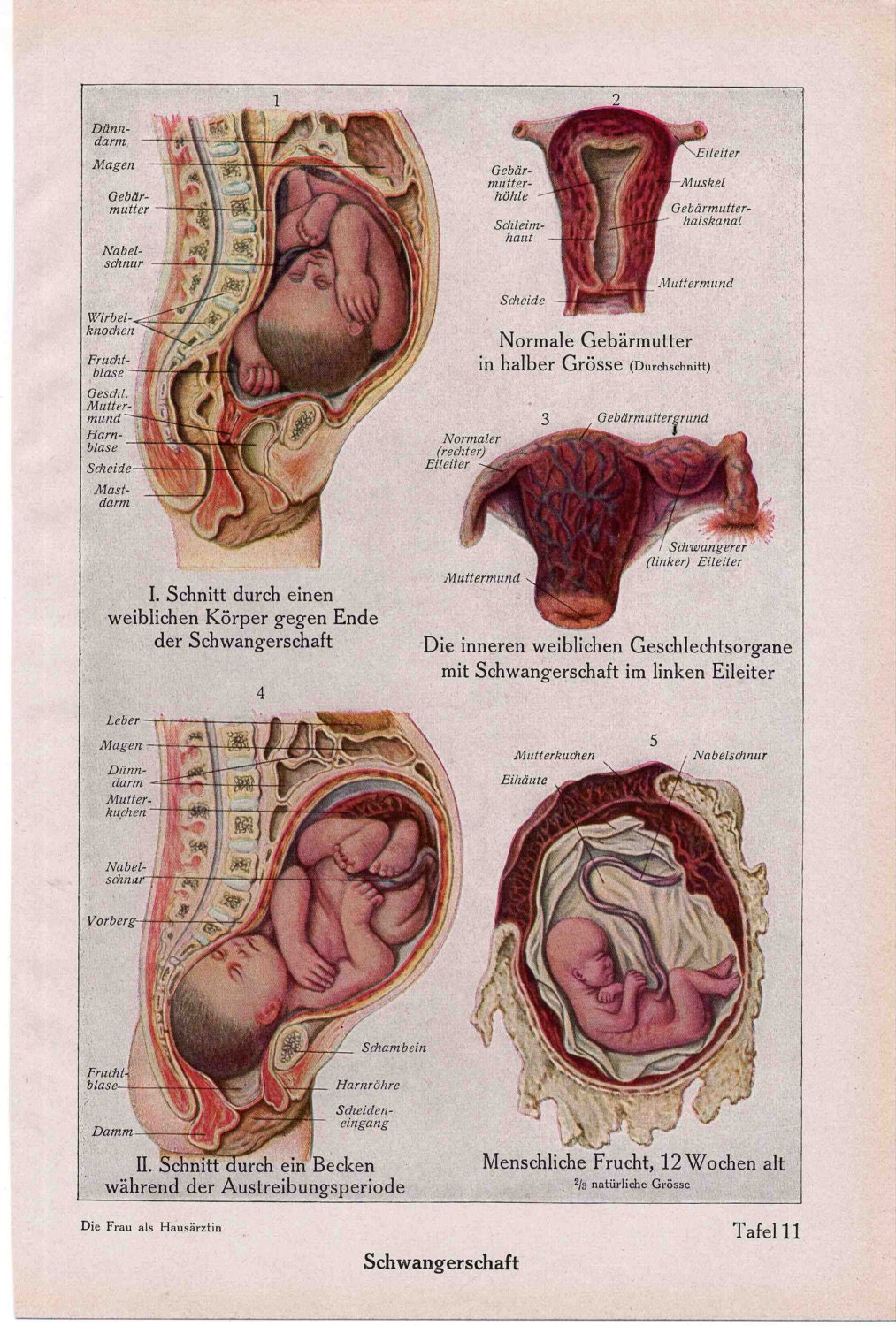 1926 birth human gestation original antique pregnant anatomy