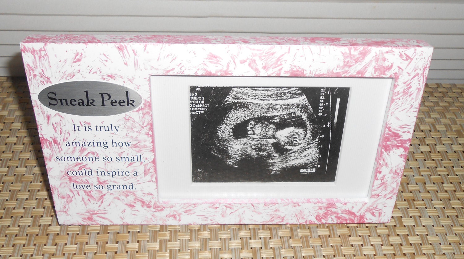 Ultrasound frame by FramesByDevora on Etsy