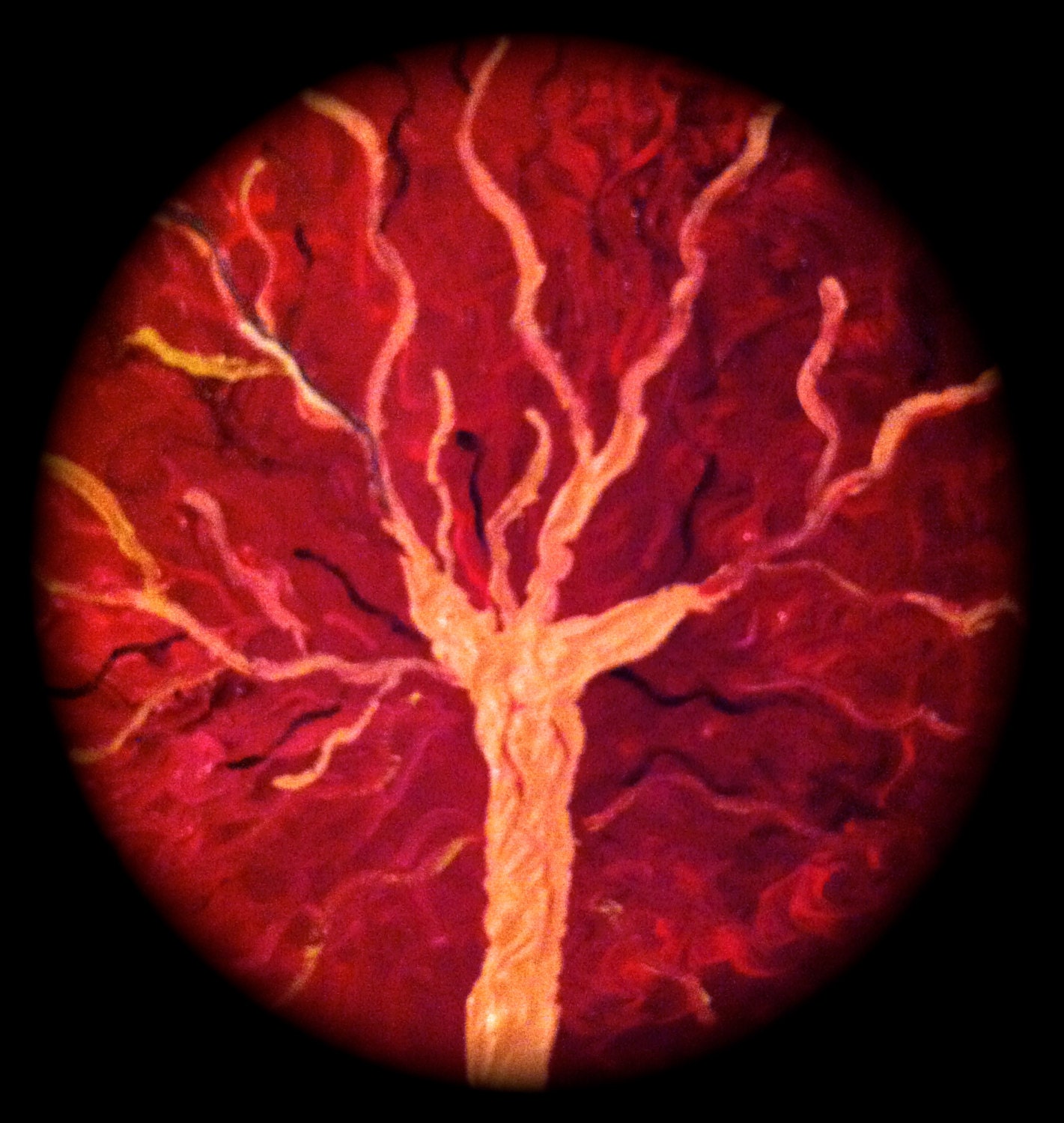 Placenta. Tree of Life. Placenta painting. Placenta print.