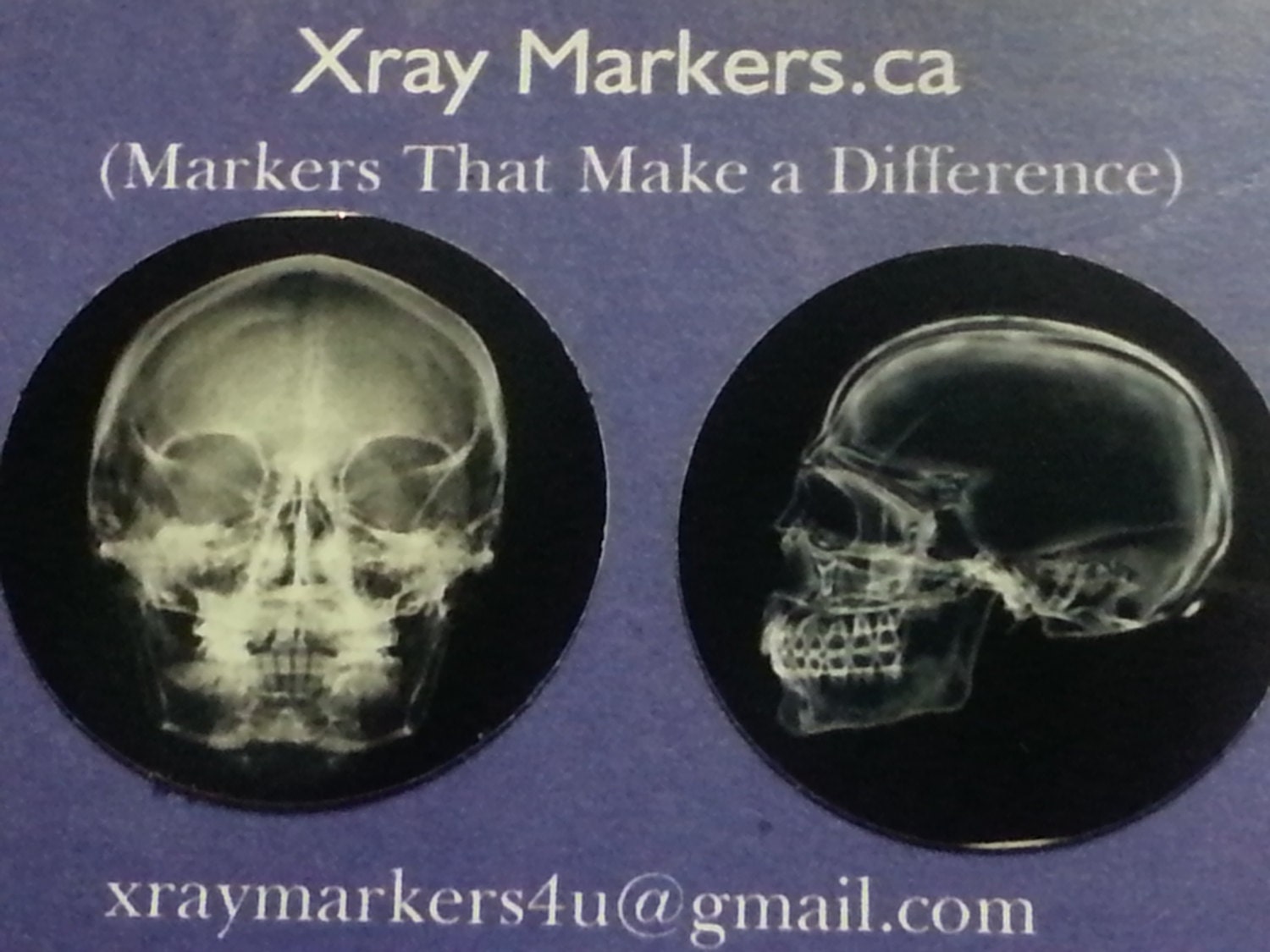 xray marker