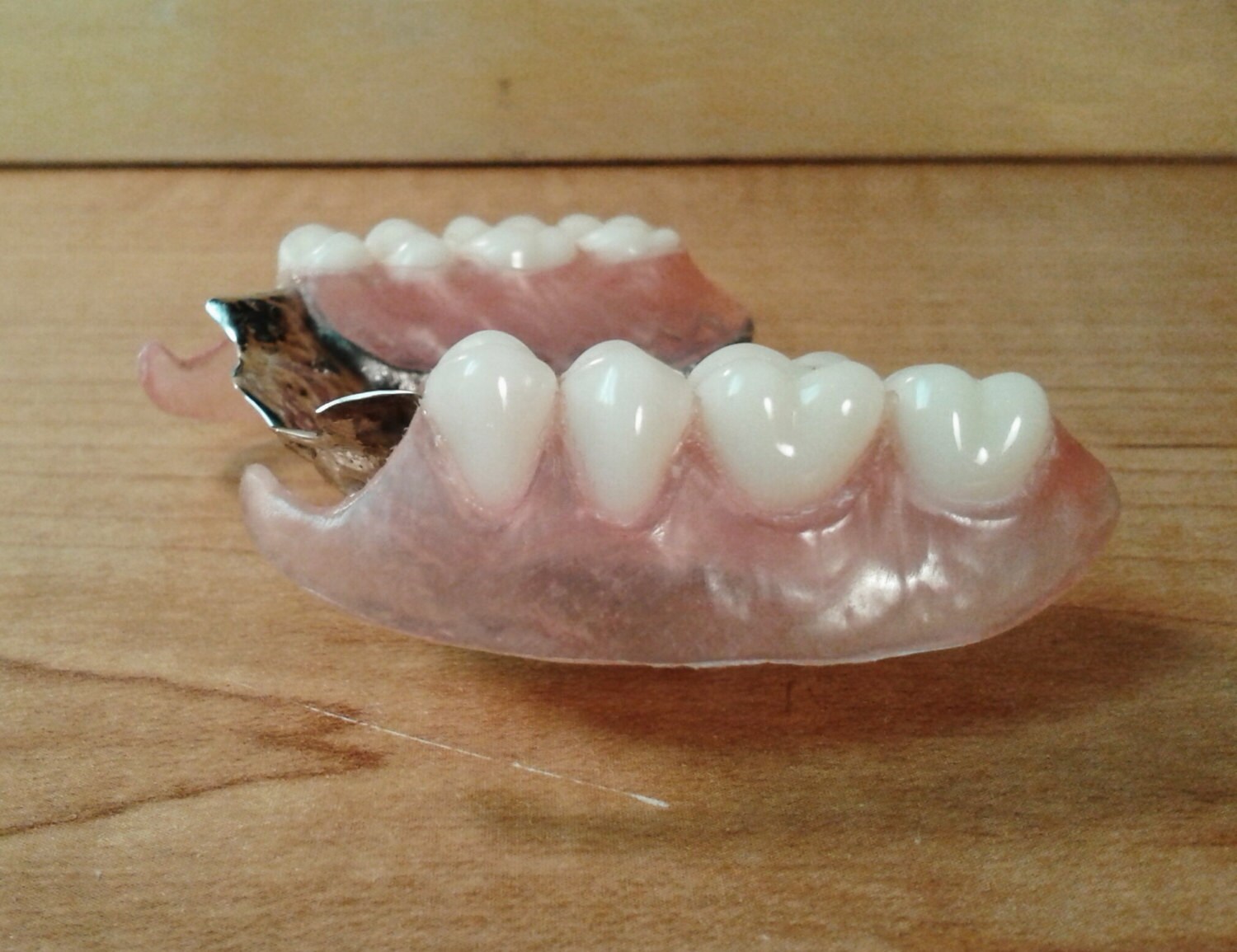 upper flexible metal partial denture by denturestore on Etsy