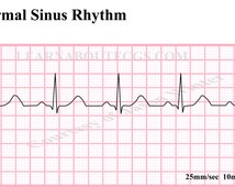 Popular items for normal sinus rhythm on Etsy