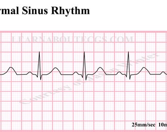 Popular items for normal sinus rhythm on Etsy