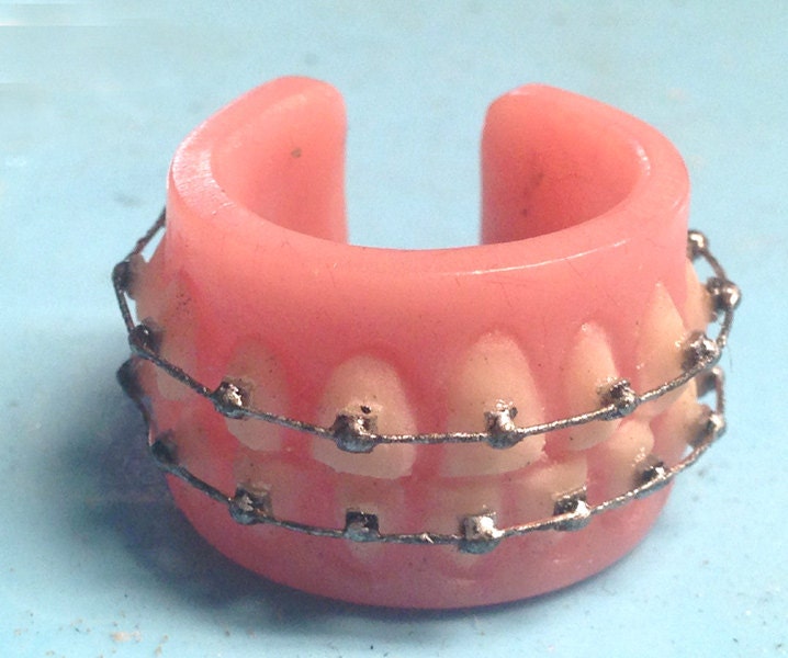 Кольцо в зубах