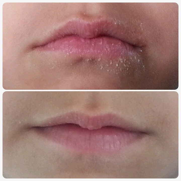 Callus Quench If its ripped or dry apply