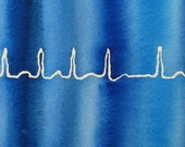 Blue Atrial Fibrillation - original watercolor ekg painting