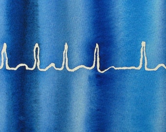 Blue Atrial Fibrillation - original watercolor ekg painting