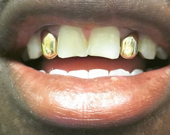 Gold Teeth 10k 6 open face bottom by GRILLZGODZ on Etsy