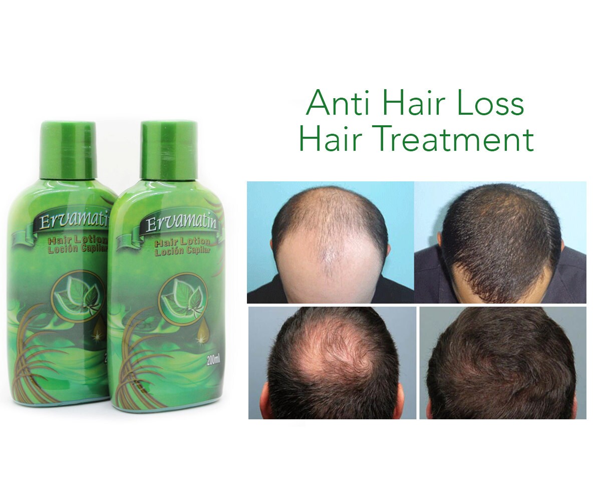 Ervamatin Anti Hair Loss Hair Regrowth lotion 200mlx2 by VevaCare