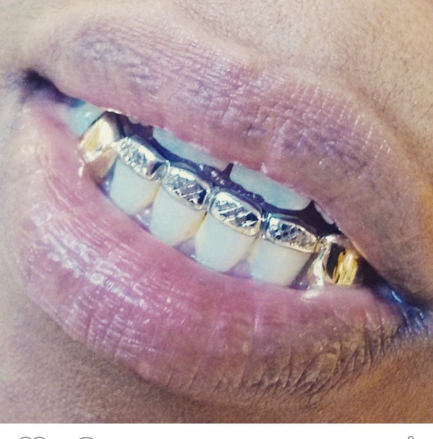10k gold teeth fangs with front bar top or bottom