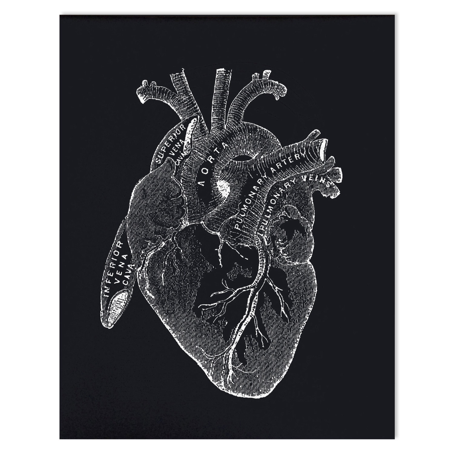 Anatomy Heart Print - Vintage Reproduction Poster. Black ...